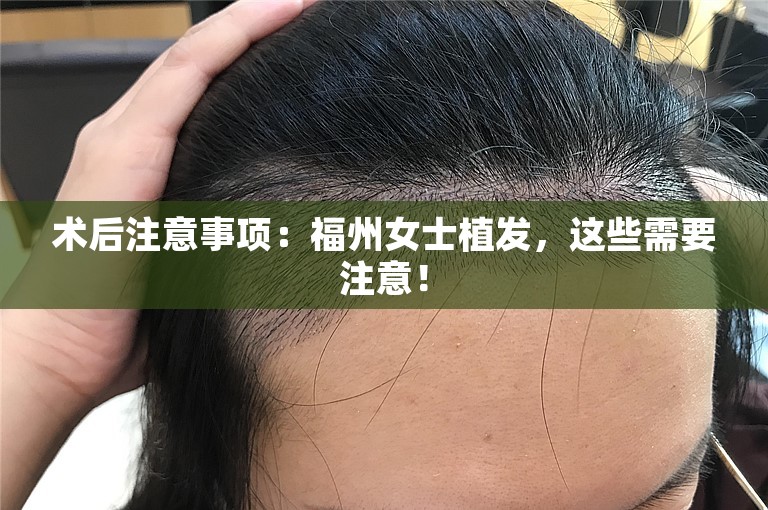 术后注意事项：福州女士植发，这些需要注意！