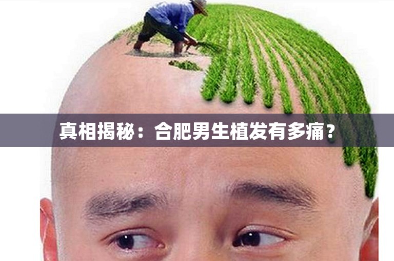 真相揭秘：合肥男生植发有多痛？