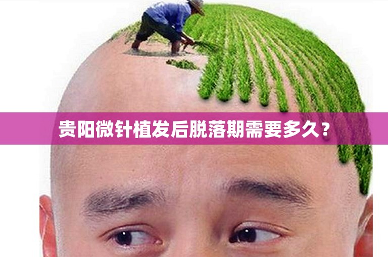 贵阳微针植发后脱落期需要多久？