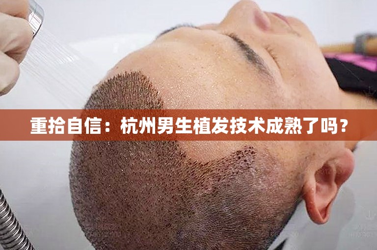 重拾自信：杭州男生植发技术成熟了吗？