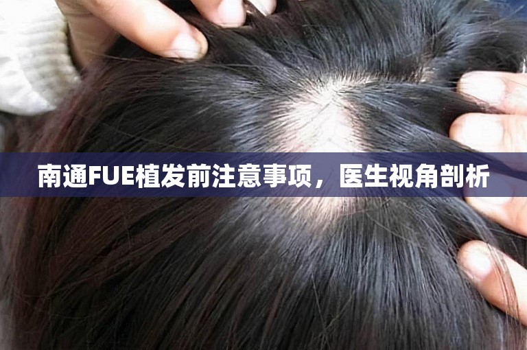 南通FUE植发前注意事项，医生视角剖析