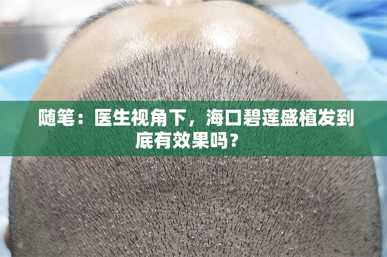  随笔：医生视角下，海口碧莲盛植发到底有效果吗？ 