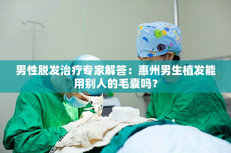 男性脱发治疗专家解答：惠州男生植发能用别人的毛囊吗？