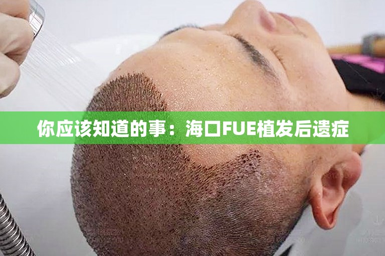 你应该知道的事：海口FUE植发后遗症