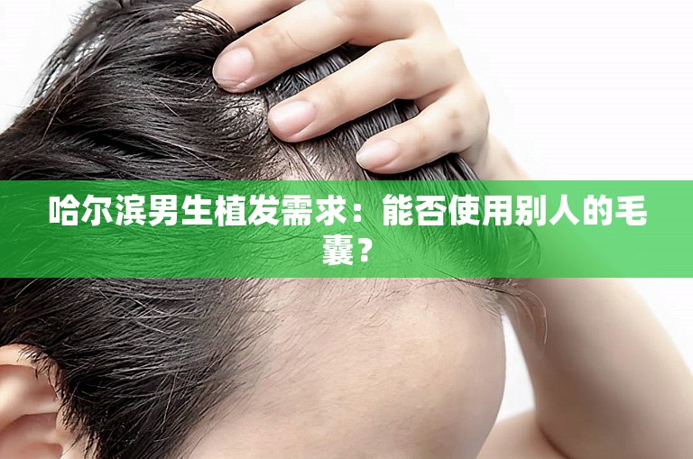 哈尔滨男生植发需求：能否使用别人的毛囊？