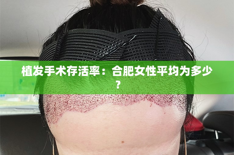 植发手术存活率：合肥女性平均为多少？