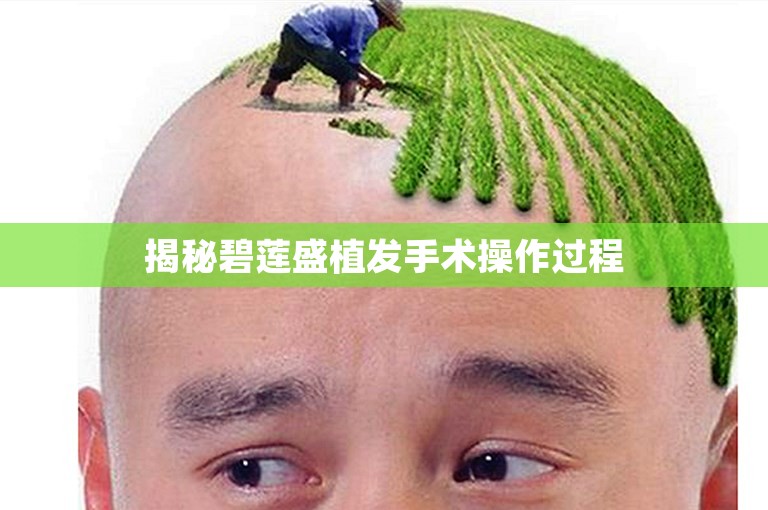 揭秘碧莲盛植发手术操作过程