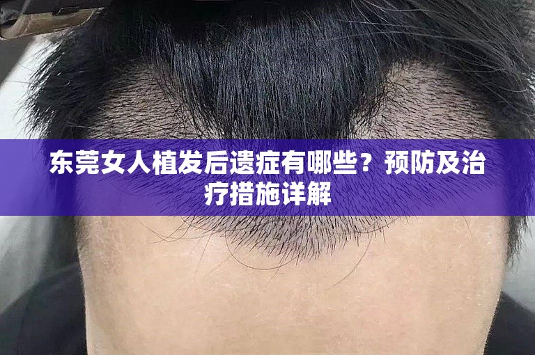 东莞女人植发后遗症有哪些？预防及治疗措施详解