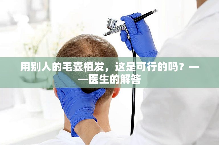 用别人的毛囊植发，这是可行的吗？——医生的解答