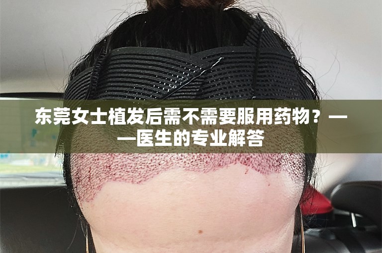 东莞女士植发后需不需要服用药物？——医生的专业解答