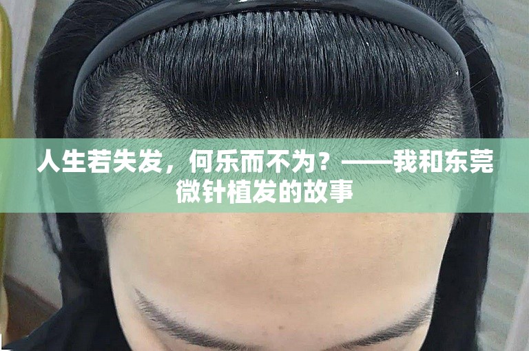 人生若失发，何乐而不为？——我和东莞微针植发的故事