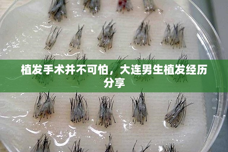 植发手术并不可怕，大连男生植发经历分享