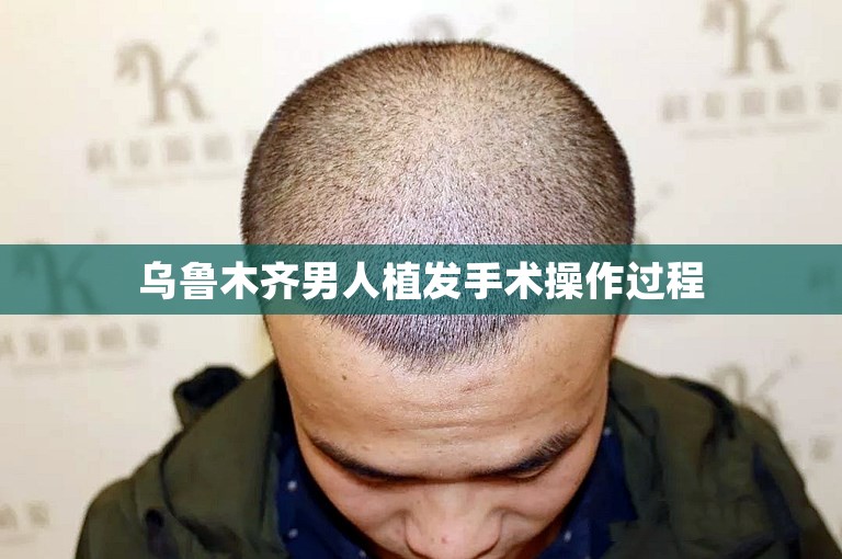 乌鲁木齐男人植发手术操作过程