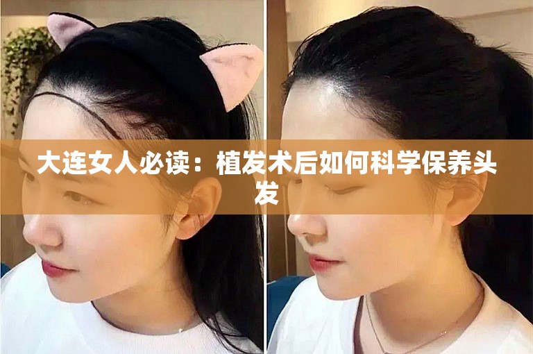 大连女人必读：植发术后如何科学保养头发