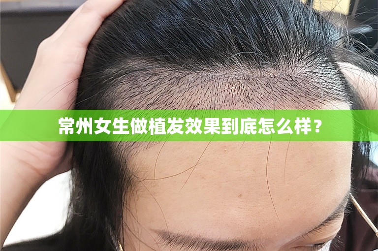 常州女生做植发效果到底怎么样？