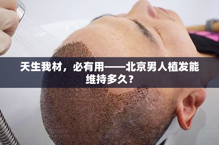 天生我材，必有用——北京男人植发能维持多久？