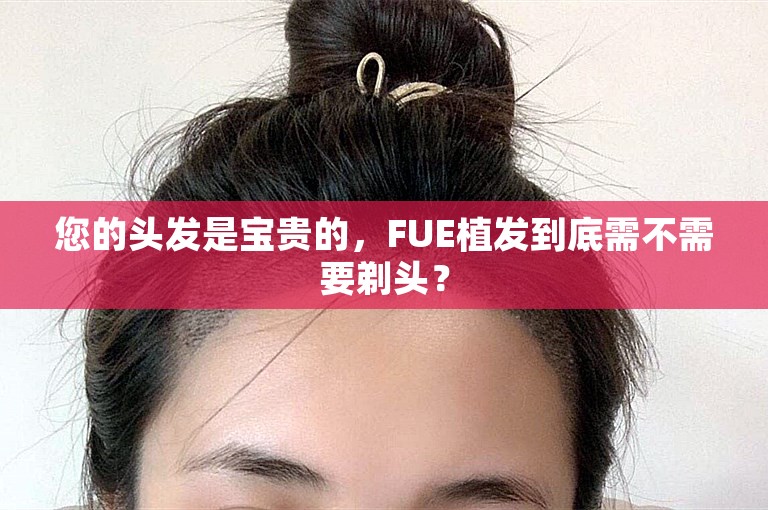 您的头发是宝贵的，FUE植发到底需不需要剃头？