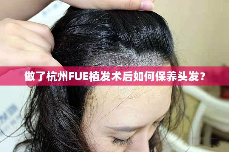 做了杭州FUE植发术后如何保养头发？