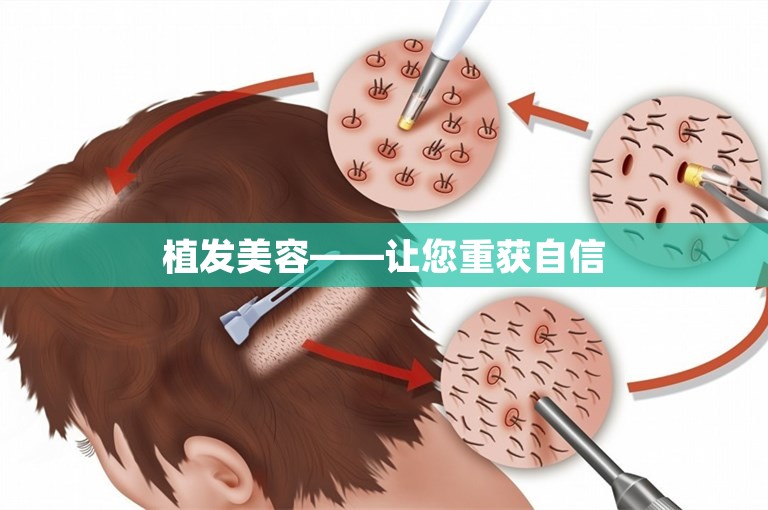 植发美容——让您重获自信