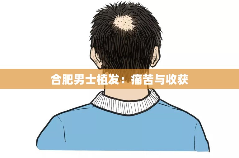 合肥男士植发：痛苦与收获