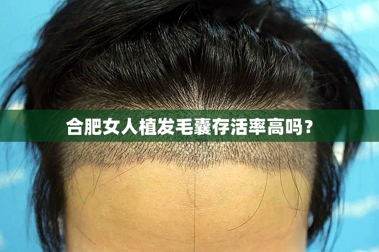 合肥女人植发毛囊存活率高吗？