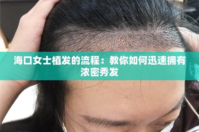 海口女士植发的流程：教你如何迅速拥有浓密秀发