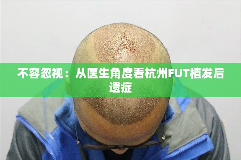 不容忽视：从医生角度看杭州FUT植发后遗症