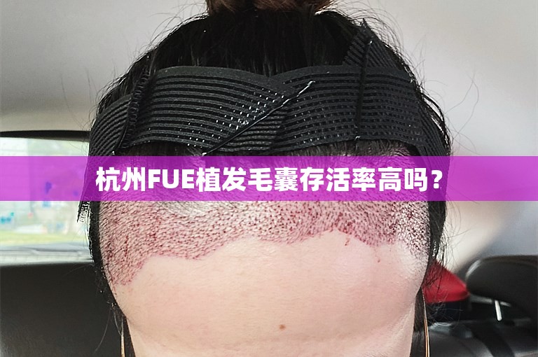 杭州FUE植发毛囊存活率高吗？