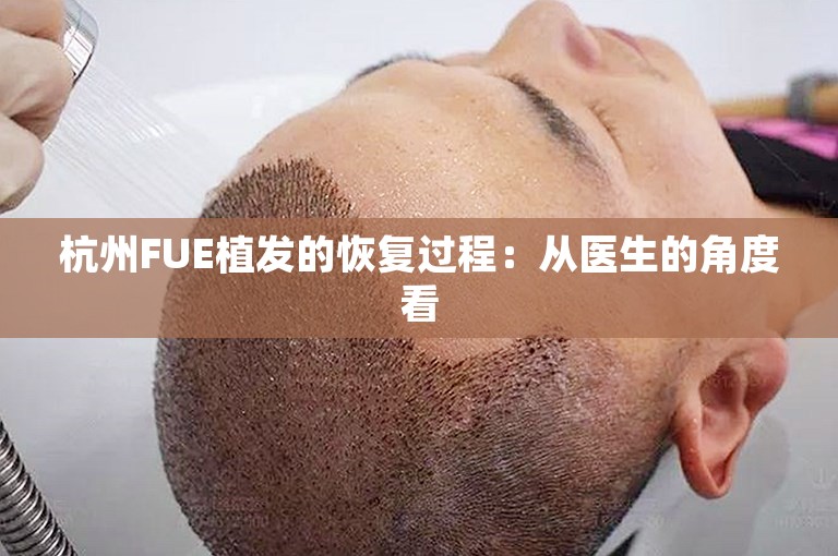 杭州FUE植发的恢复过程：从医生的角度看