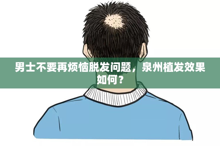 男士不要再烦恼脱发问题，泉州植发效果如何？