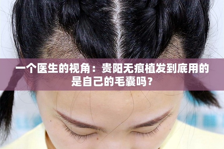 一个医生的视角：贵阳无痕植发到底用的是自己的毛囊吗？