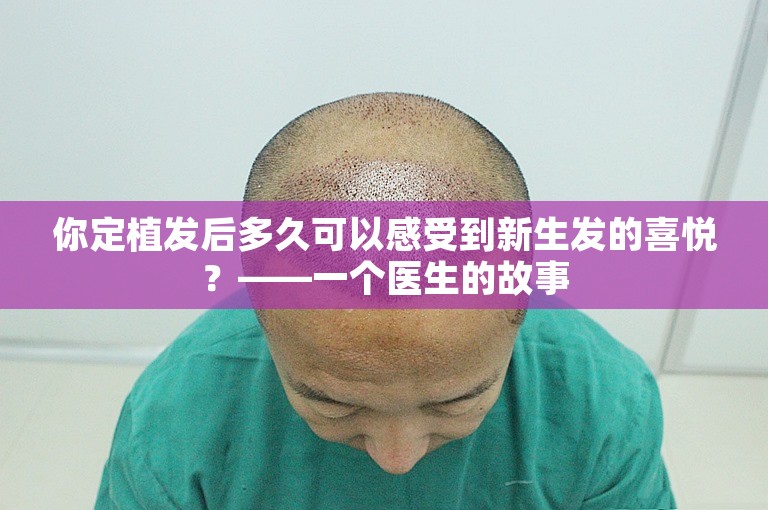 你定植发后多久可以感受到新生发的喜悦？——一个医生的故事