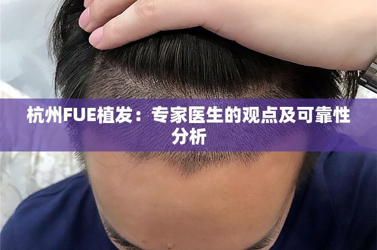 杭州FUE植发：专家医生的观点及可靠性分析