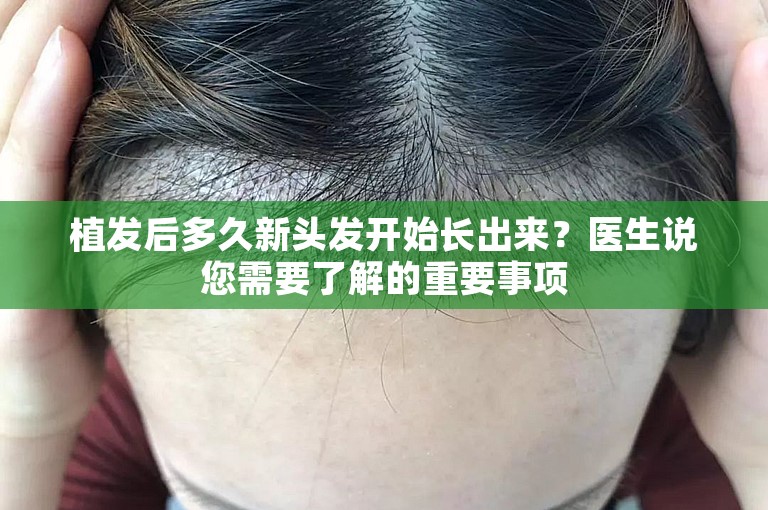 植发后多久新头发开始长出来？医生说您需要了解的重要事项