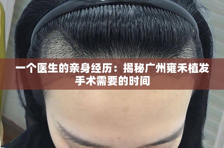 一个医生的亲身经历：揭秘广州雍禾植发手术需要的时间