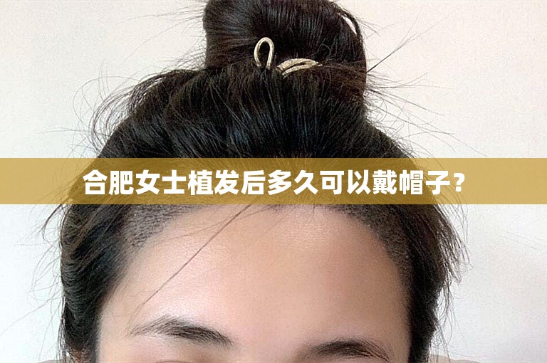 合肥女士植发后多久可以戴帽子？