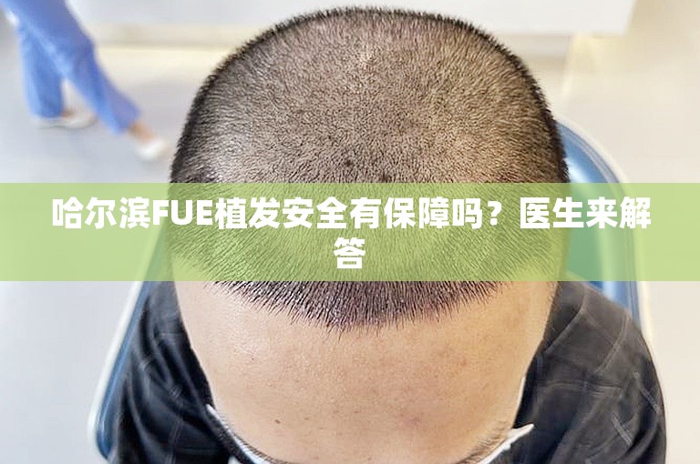 哈尔滨FUE植发安全有保障吗？医生来解答