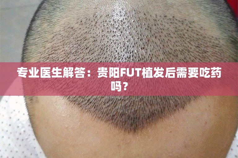 专业医生解答：贵阳FUT植发后需要吃药吗？