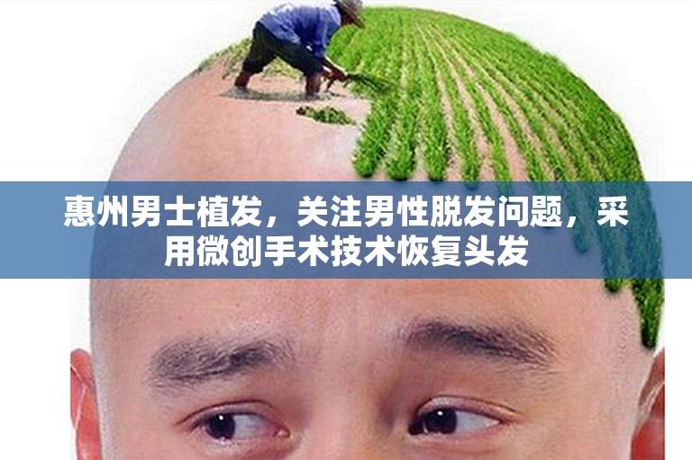 惠州男士植发，关注男性脱发问题，采用微创手术技术恢复头发