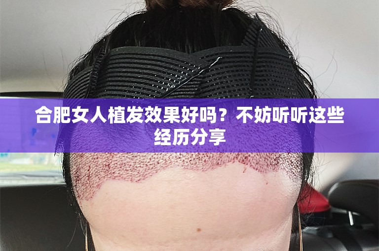 合肥女人植发效果好吗？不妨听听这些经历分享