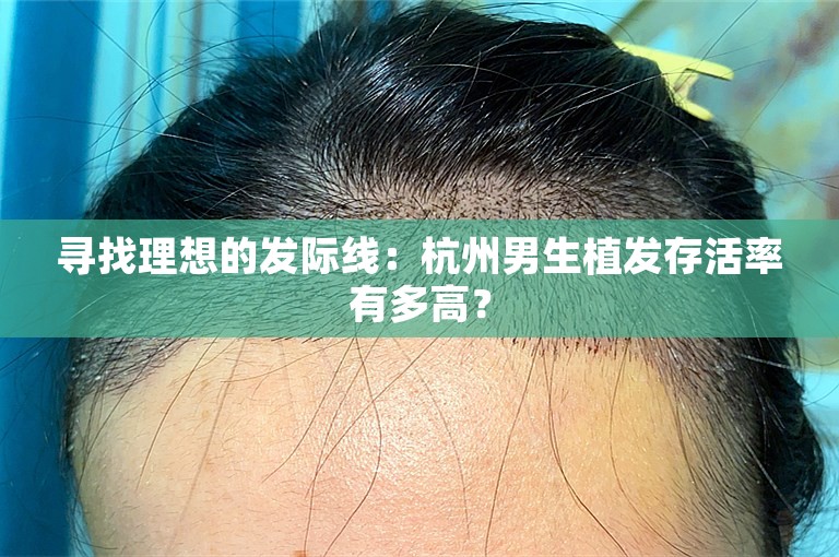 寻找理想的发际线：杭州男生植发存活率有多高？