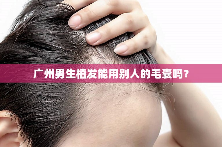 广州男生植发能用别人的毛囊吗？