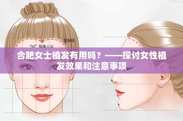 合肥女士植发有用吗？——探讨女性植发效果和注意事项