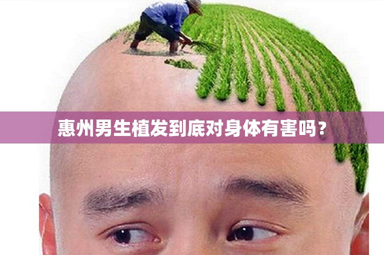 惠州男生植发到底对身体有害吗？