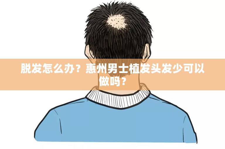 脱发怎么办？惠州男士植发头发少可以做吗？