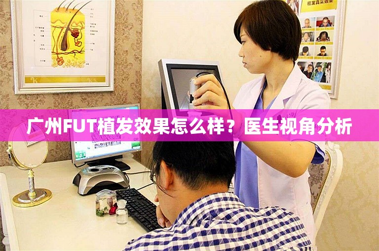 广州FUT植发效果怎么样？医生视角分析