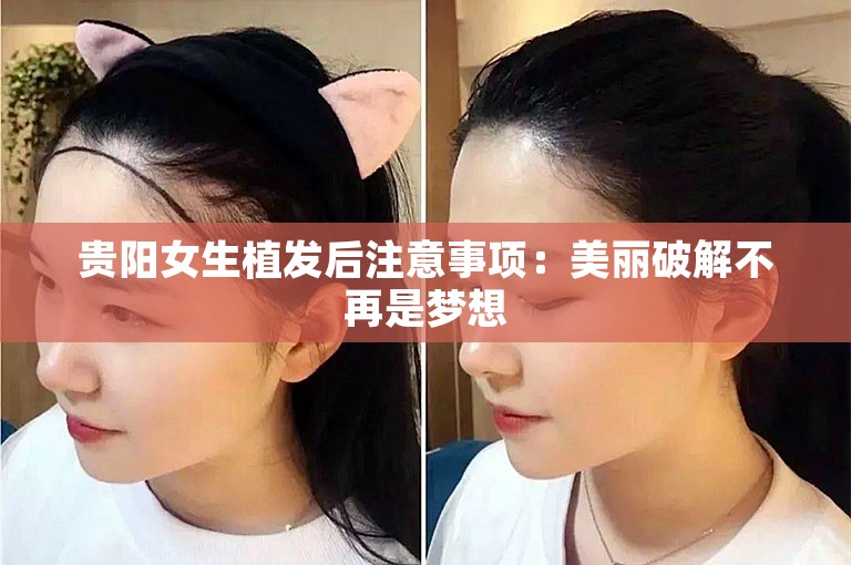 贵阳女生植发后注意事项：美丽破解不再是梦想