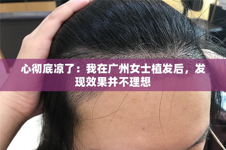 心彻底凉了：我在广州女士植发后，发现效果并不理想