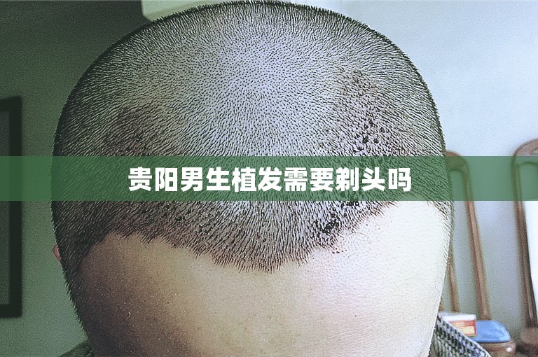 贵阳男生植发需要剃头吗