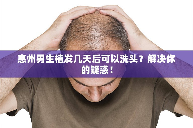 惠州男生植发几天后可以洗头？解决你的疑惑！